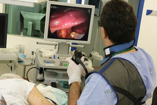 Realização do exame de endoscopia Realização do exame de endoscopia