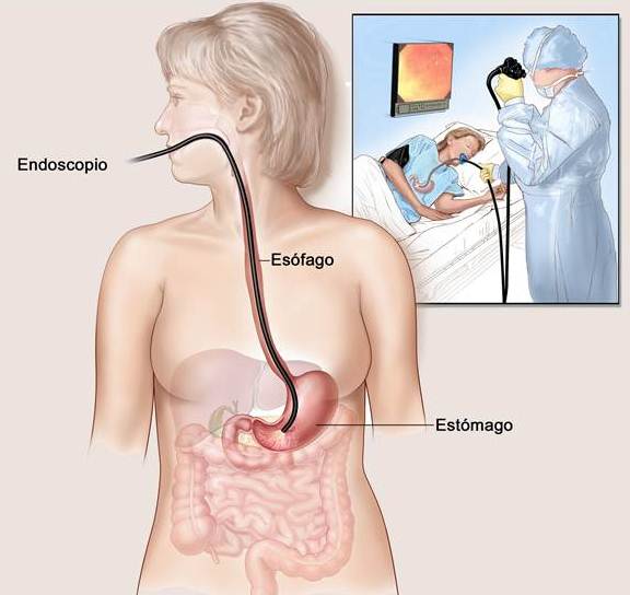Procedimento da endoscopia Procedimento da endoscopia