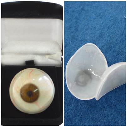 Prótese ocular