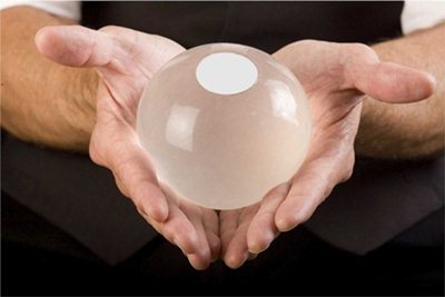 Colocação Balão Intragástrico Colocação Balão Intragástrico