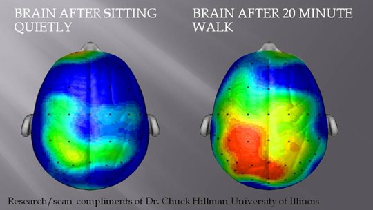 cerebro cerebro